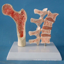 Human Femur and Spine Skeleton Anatomical Model for Demonstration